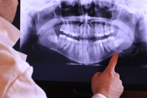 Best 24-Hour Emergency Dental Care in Hope Valley, RI
